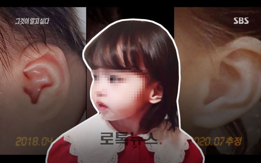 '구미 아동 사망사건' 결정적 증거 될 귀 사진…미성년자 약취 무죄가 나올 확률 낮아졌다 기사 관련이미지
