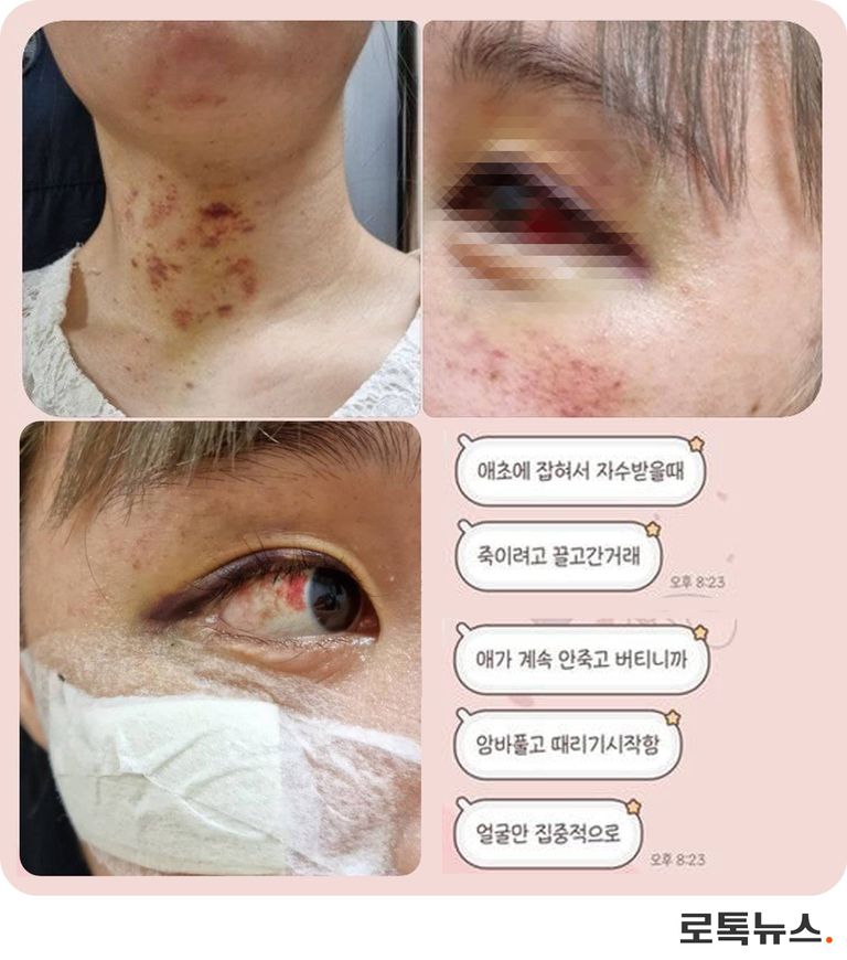 SNS에 공개된 B씨의 피해 사진. /트위터 캡처⋅편집=조소혜 디자이너