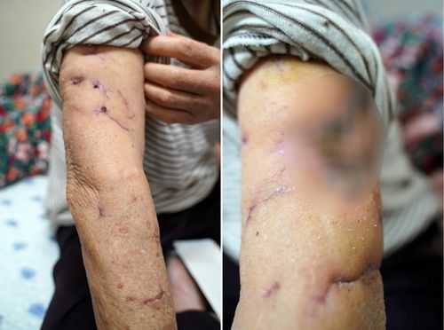 80대 노인 '덮친' 사냥개 3마리…치료비 줬다고 '끝' 아닙니다 기사 관련이미지