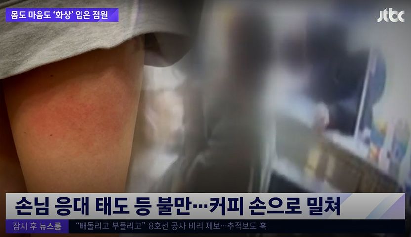 직원 허벅지에 뜨거운 커피 엎은 행동, 징역으로 이어질 수 있습니다 기사 관련이미지