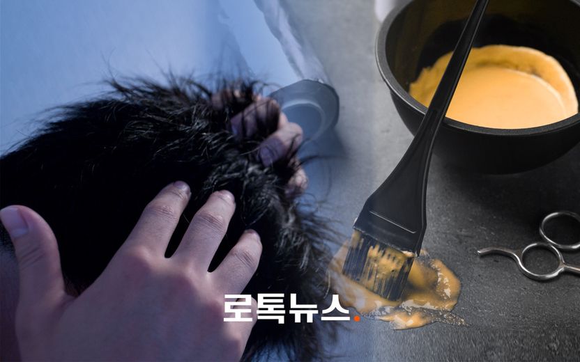 직원 실수로 탈모 증상…"배상 못 해준다"는 미용실, 사실 형사 처벌까지도 가능한 사안 기사 관련이미지