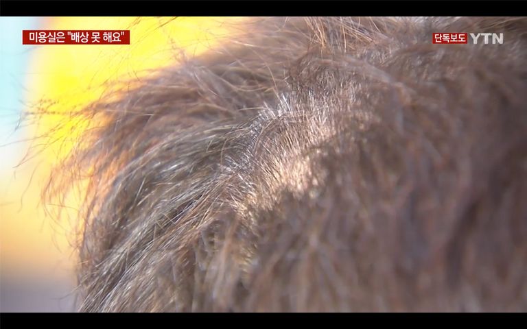 한 프랜차이즈 미용실 직원이 실수로 염색약에 다른 약품을 넣는 바람에 손님이 탈모 증상을 얻었다. /YTN 캡처