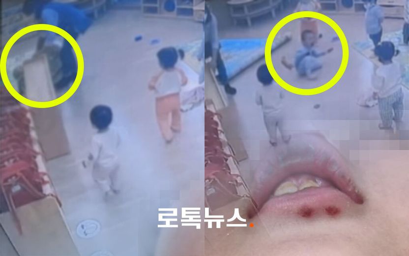 두 살 아이가 울면서 피 '뚝뚝' 흘리는데…어린이집 교사는 바닥에 떨어진 피만 닦았다 기사 관련이미지