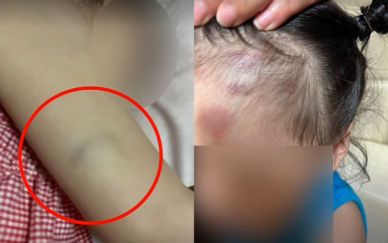 CCTV 보고 그 자리에서 쓰러진 엄마…그날 어린이집에선 무슨 일이 기사 관련이미지