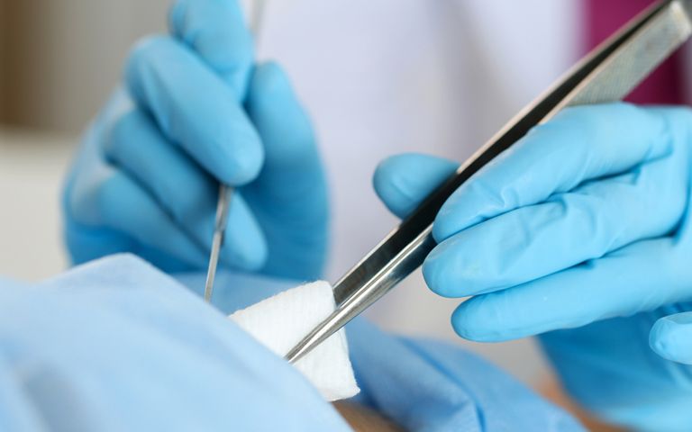 실밥 대신 뽑은 게 죄가 아니라, 실밥 뽑기 전 체크 안 한 게 죄였다 기사 관련이미지