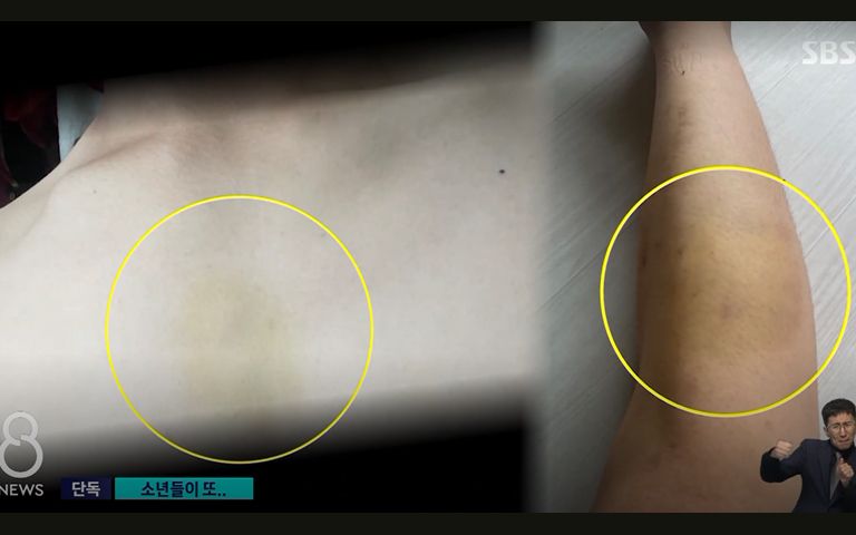 훔친 렌터카로 알바하던 대학 신입생 치어 숨지게 한 촉법소년들, 이번엔… 기사 관련이미지