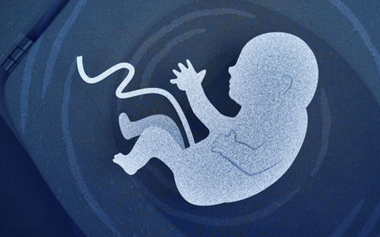 아이 낳자마자 숨지게 하고 유기까지 한 여성이 '선처' 받은 이유 기사 관련이미지