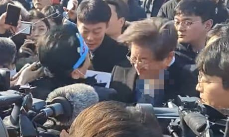 이재명 경정맥 손상 대량 출혈 우려…서울대병원서 수술 예정 기사 관련이미지