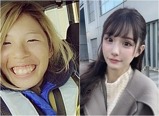 2억 들여 25번 성형 수술한 日여성…“인생 180도 바뀌었다” 기사 관련이미지