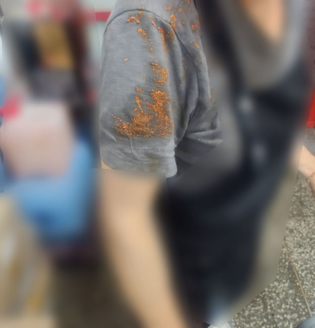 떡볶이 모자라다며…가게 찾아가 얼굴에 음식 던진 손님, 형사·민사 모두 간다 기사 관련이미지