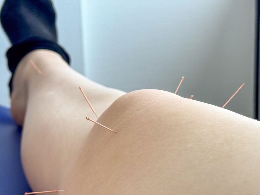 명확한 거부 의사에도 한의사가 손으로 10여 차례 환자 엉덩이 두드려…어떤 죄 적용 하지? 기사 관련이미지