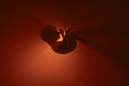 엽산이라고 속이고 낙태약 먹인 유부남…7년 속은 연인의 '1억짜리 반격' 기사 관련이미지