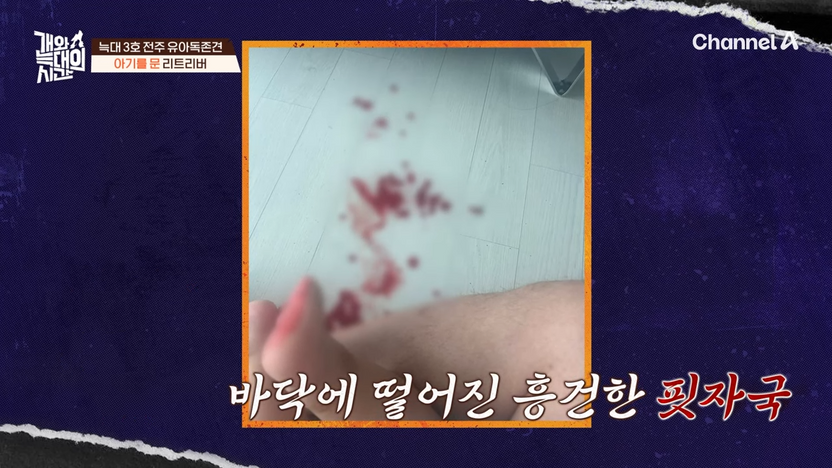 16개월 아기 물었는데…"개도 가족"이라며 완강한 아내, 명백한 이혼 사유 기사 관련이미지