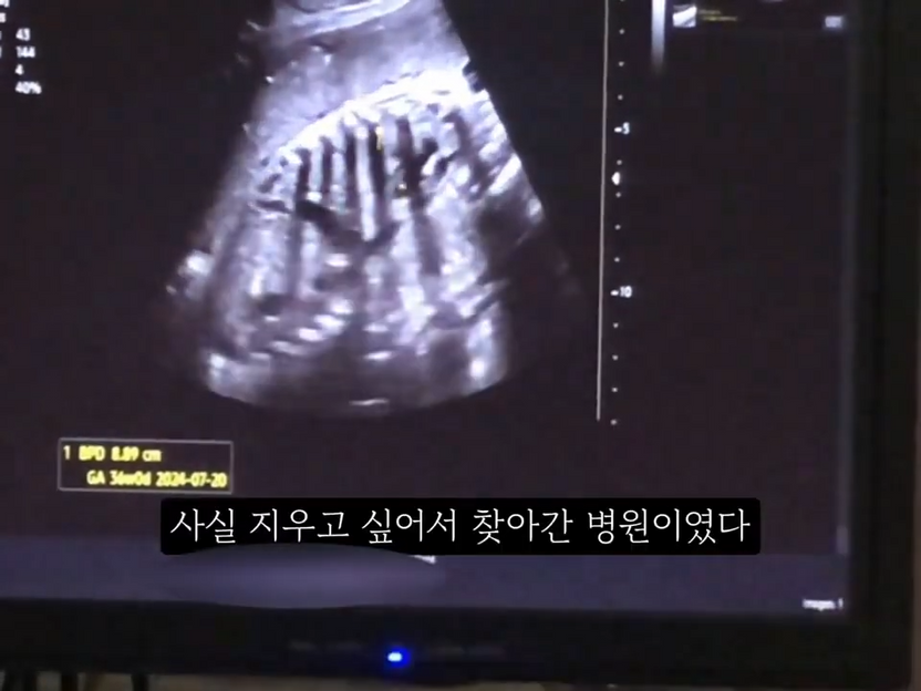 '36주 태아' 제왕절개로 꺼내 냉동고에…산모는 "살인 고의 없었다" 부인 기사 관련이미지