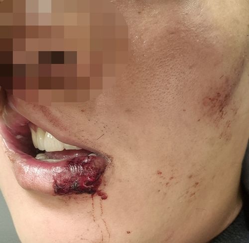 신고자에 무릎 꿇고 제압, 갈비뼈 부러뜨린 경찰... '과잉 체포' 법적 쟁점은? 기사 관련이미지