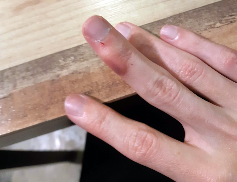 필기로 퉁퉁 부은 손