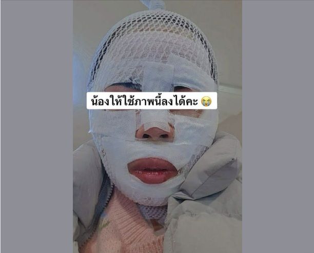 "못생기게 만들고 싶었다"… 잠든 아내에 끓는 물 부은 남편 기사 관련이미지