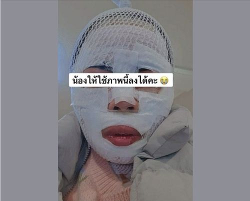 펄펄 끓는 물, 칫솔에 뿌린 락스…칼보다 무서운 일상 속 흉기, 법으로 보면? 기사 관련이미지