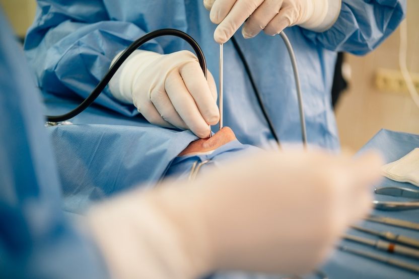 남편 숨진 병원서 날아온 '리뷰 이벤트' 문자... 수면내시경 사망 사고, 누구 책임일까 기사 관련이미지