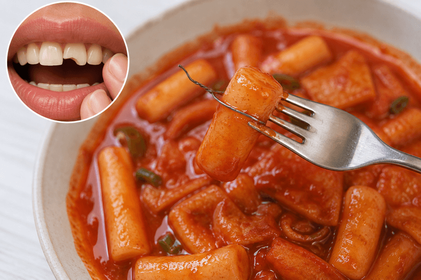 떡볶이 먹다 씹은 철사⋯ 떡 공장 사장님 책임일까? 분식집 사장님 책임일까? 기사 관련이미지