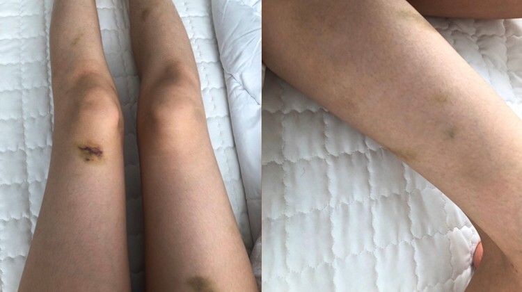 '민주당 인재영입 2호 원종건의 실체를 폭로합니다'는 제목의 글에서 A씨는 원씨가 자신을 성 노리개 취급을 하고 '가스라이팅'(gaslighting)을 했다고 주장했다. /인터넷 커뮤니티 캡처