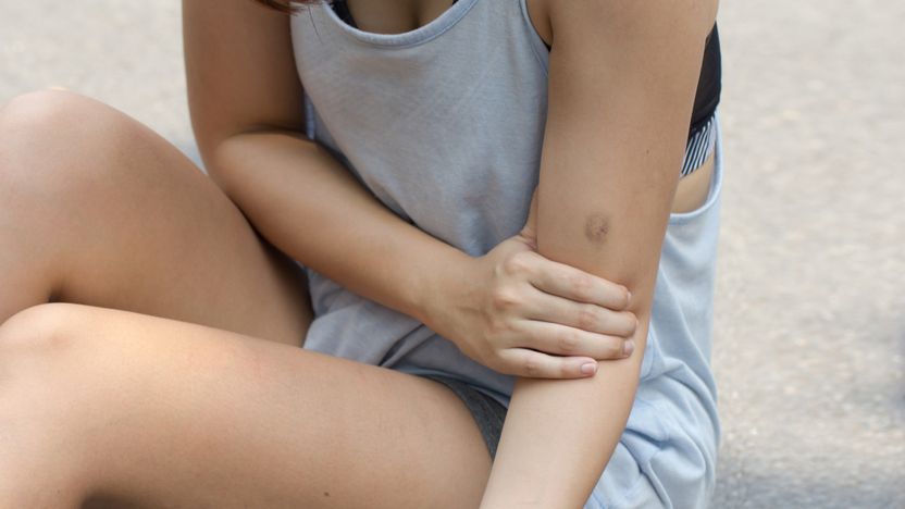 남편의 지속적인 '꼬집기'⋯ 이혼 사유로 충분합니다 기사 관련이미지